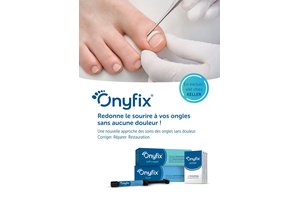 Onyfix Marketingmaterial
