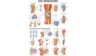 RÜDIGER Lehrtafel Kniegelenk